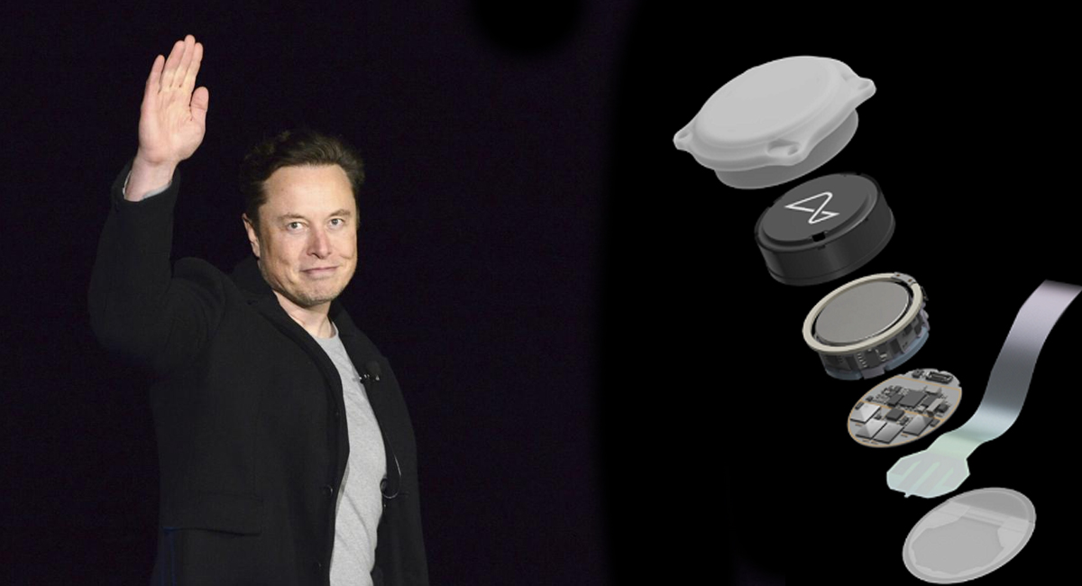 MUSK
