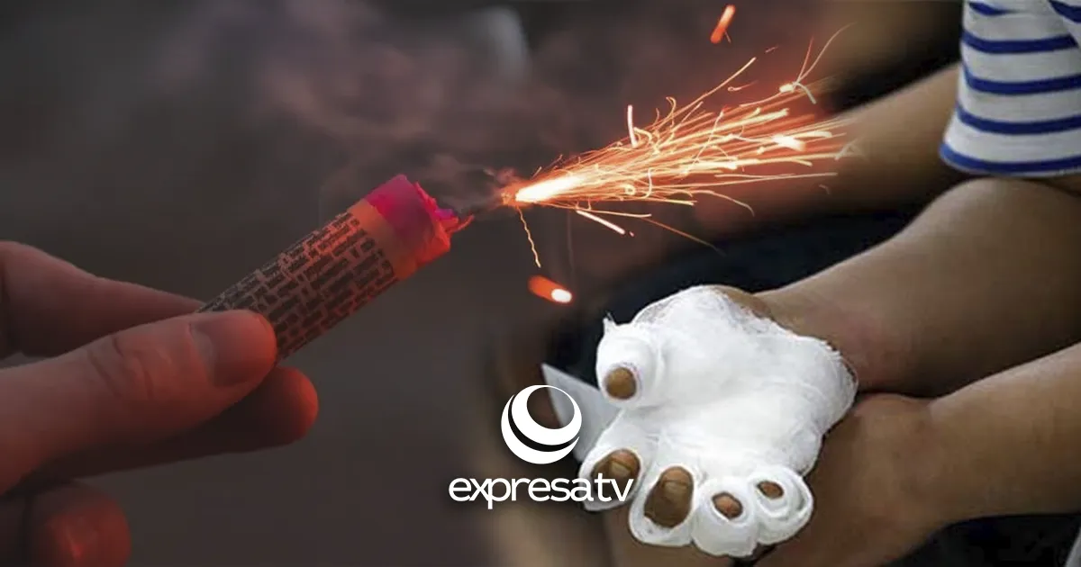 PIROTECNIA QUEMADURA